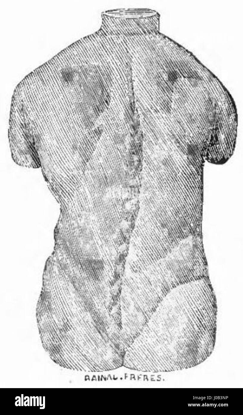 Der „Catalogue de Corsets de Rainal Frères Fig. 479“ zeigt eine detaillierte Illustration eines Korsetts, das die Modetrends des späten 19. Jahrhunderts widerspiegelt, wobei der Schwerpunkt auf Struktur und Dekoration des Kleidungsstücks liegt. Stockfoto