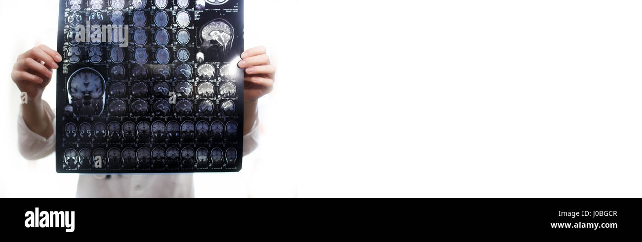 Arzt hält ein Bild eines Gehirns MRI Stockfoto