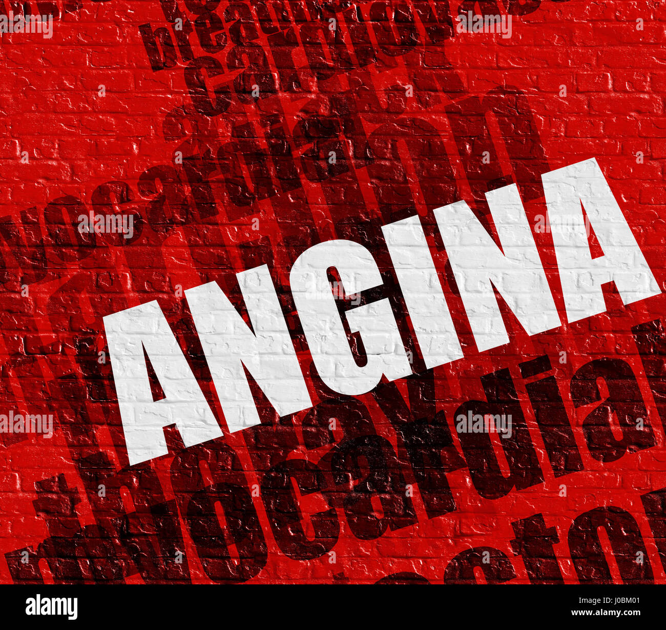 Medizinisches Konzept: Angina auf die rote Wand. Stockfoto