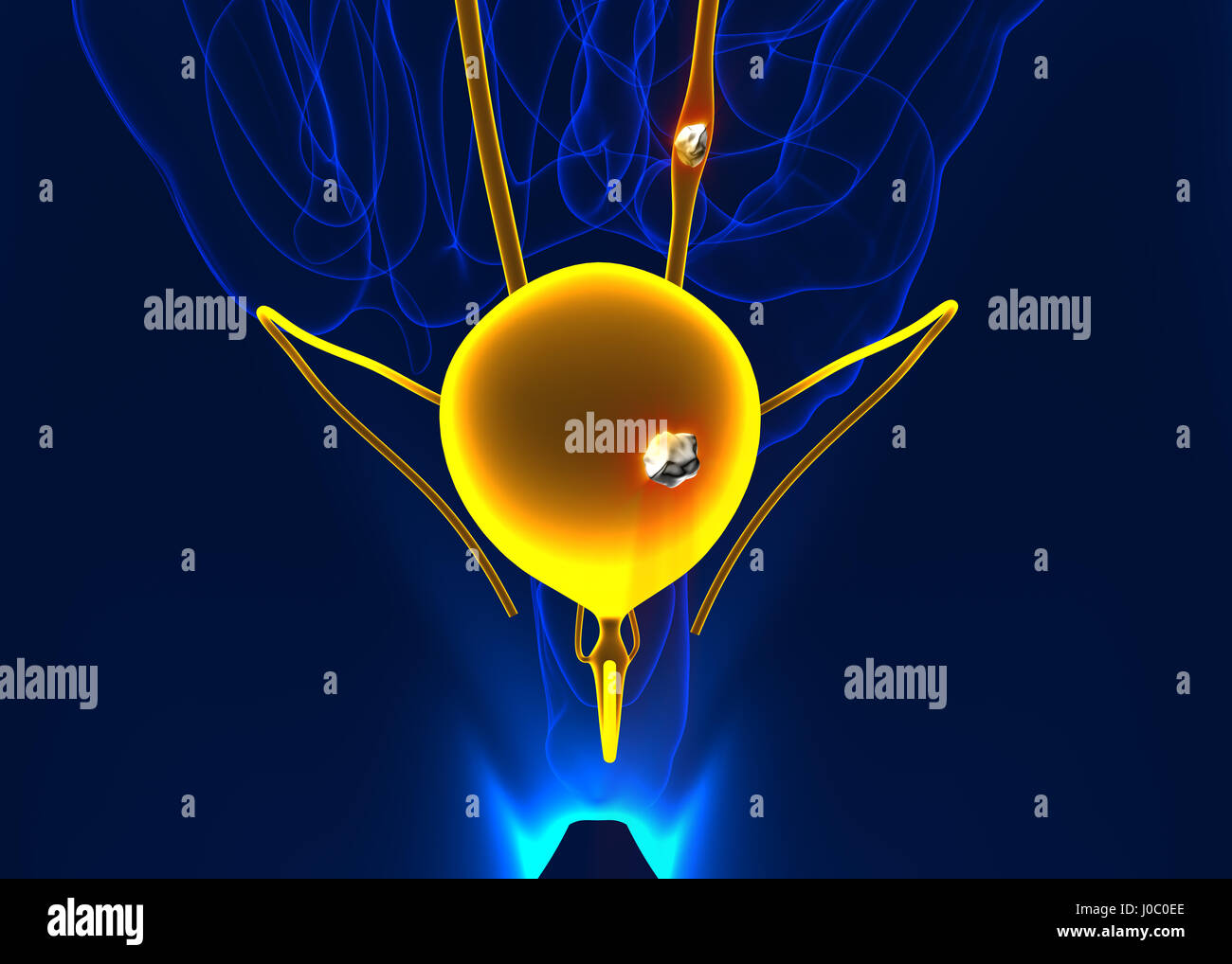 Harnsteine Anatomie Schmerz männliche interne Organ schmerzhaft kristallklarem mineralischen Querschnitt - 3d illustration Stockfoto