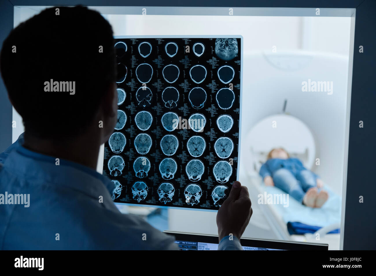 Professionellen männlichen Onkologe mit Blick auf die MRI Scan Bild Stockfoto