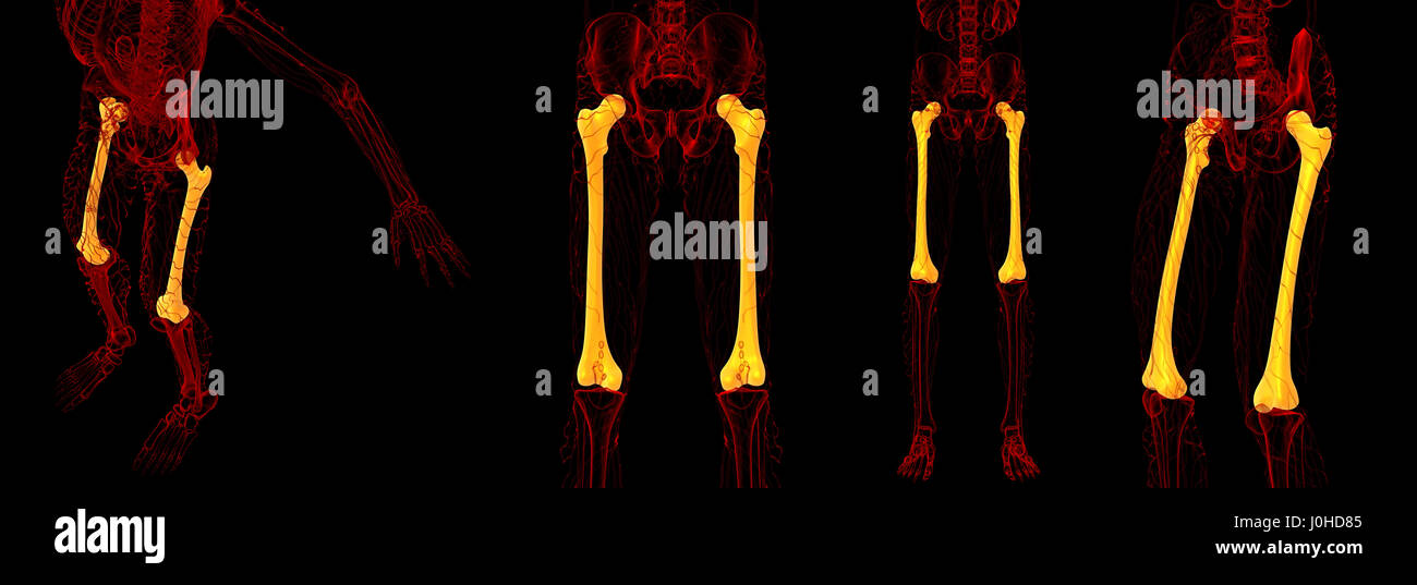 3D Rendering medizinische Illustration von der Oberschenkelknochen