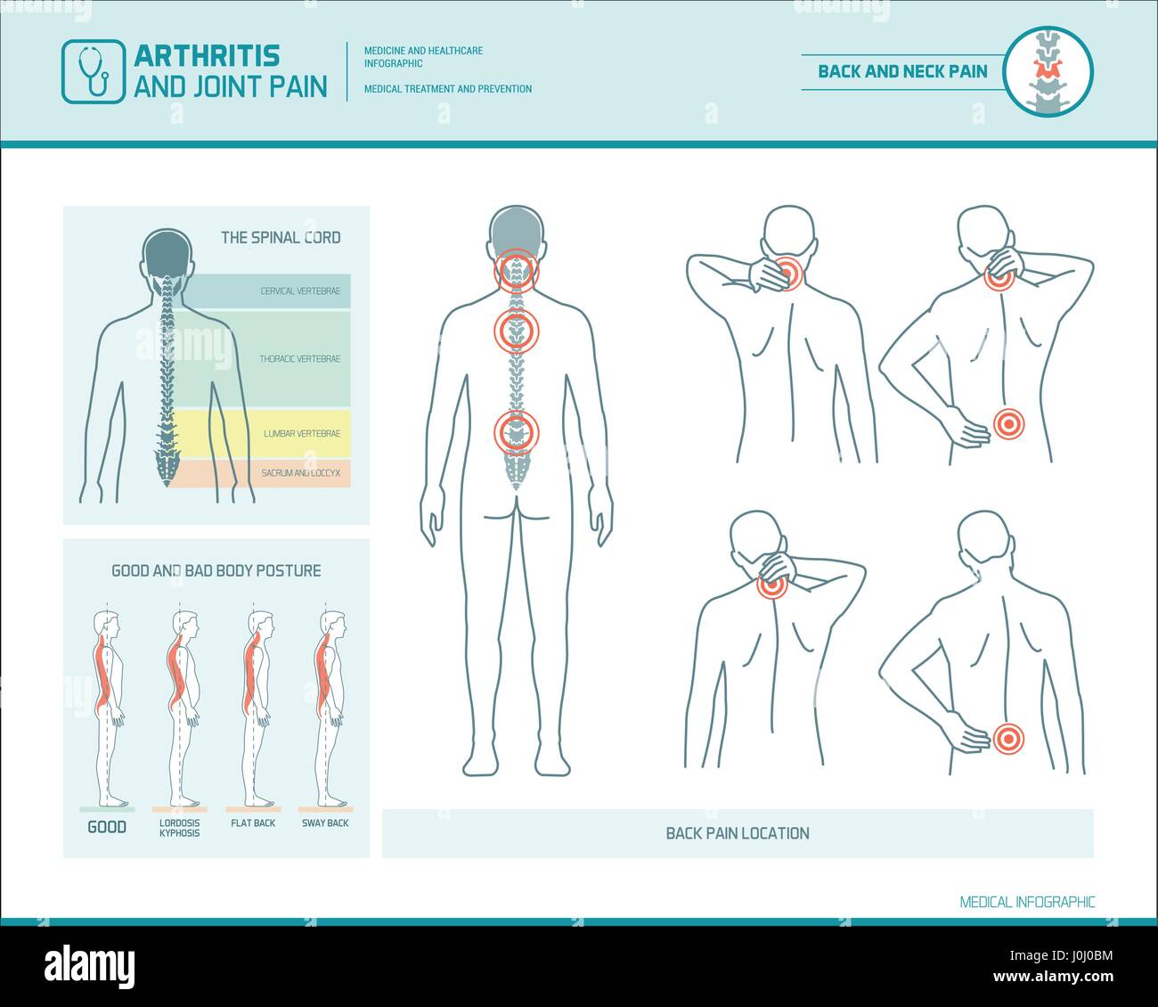 Rückseitige Schmerz und Körper Haltung Infografik mit anatomischen Abbildungen Stock Vektor