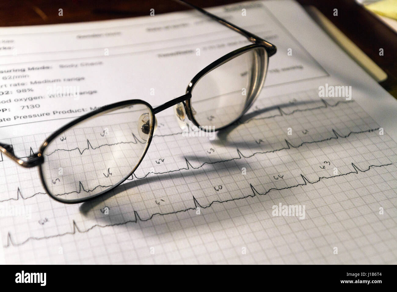 Stillleben mit eine Seite mit einem Elektrokardiogramm (EKG) Herzschlag Diagramm mit Brille ruht auf der Stockfoto