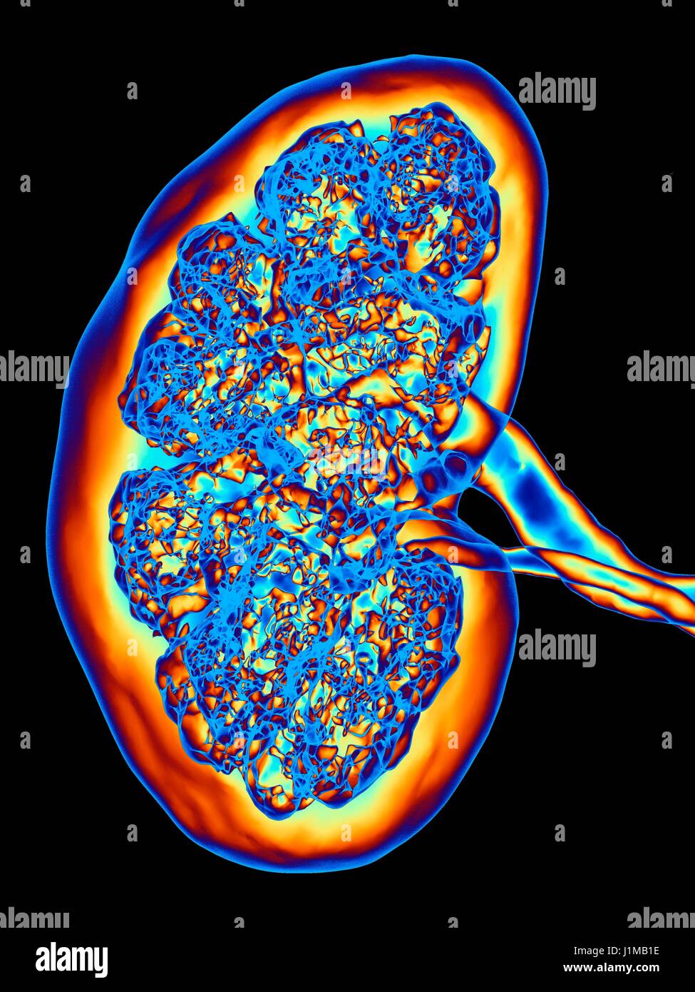 Niere, CT-Scan. Falsche Farbe 3-d Computertomographie (CT) Scan einer Niere in Frontalansicht. Stockfoto