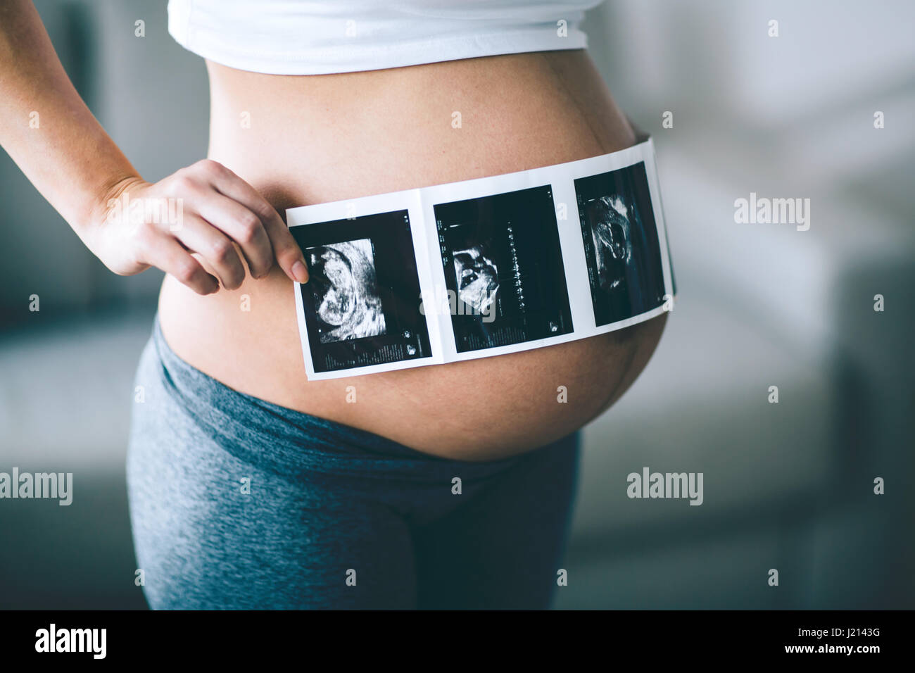 Schöne schwangere Frau mit Ultraschall am Bauch Stockfoto