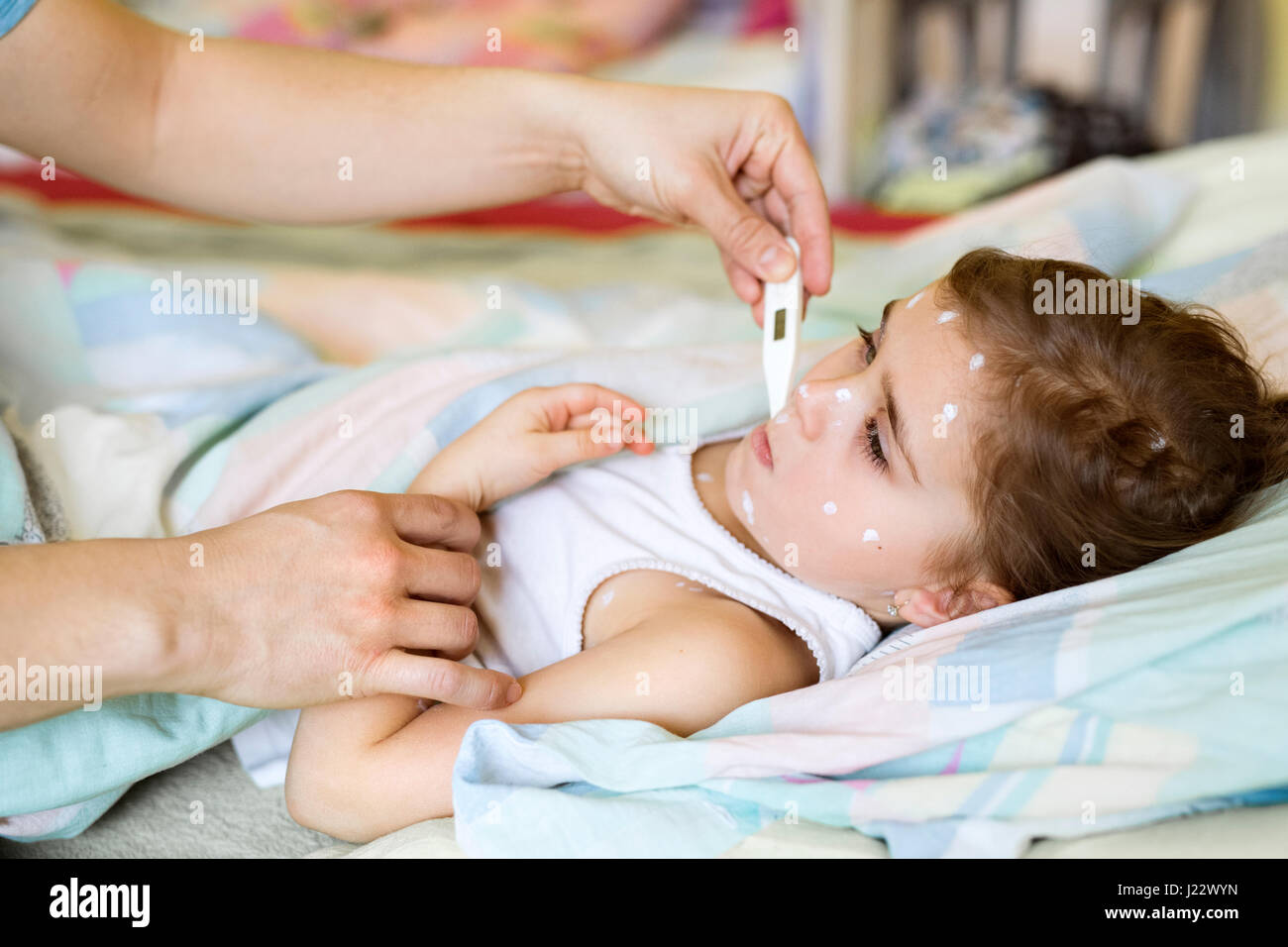 Mädchen mit Windpocken im Bett mit Fieberthermometer Stockfoto