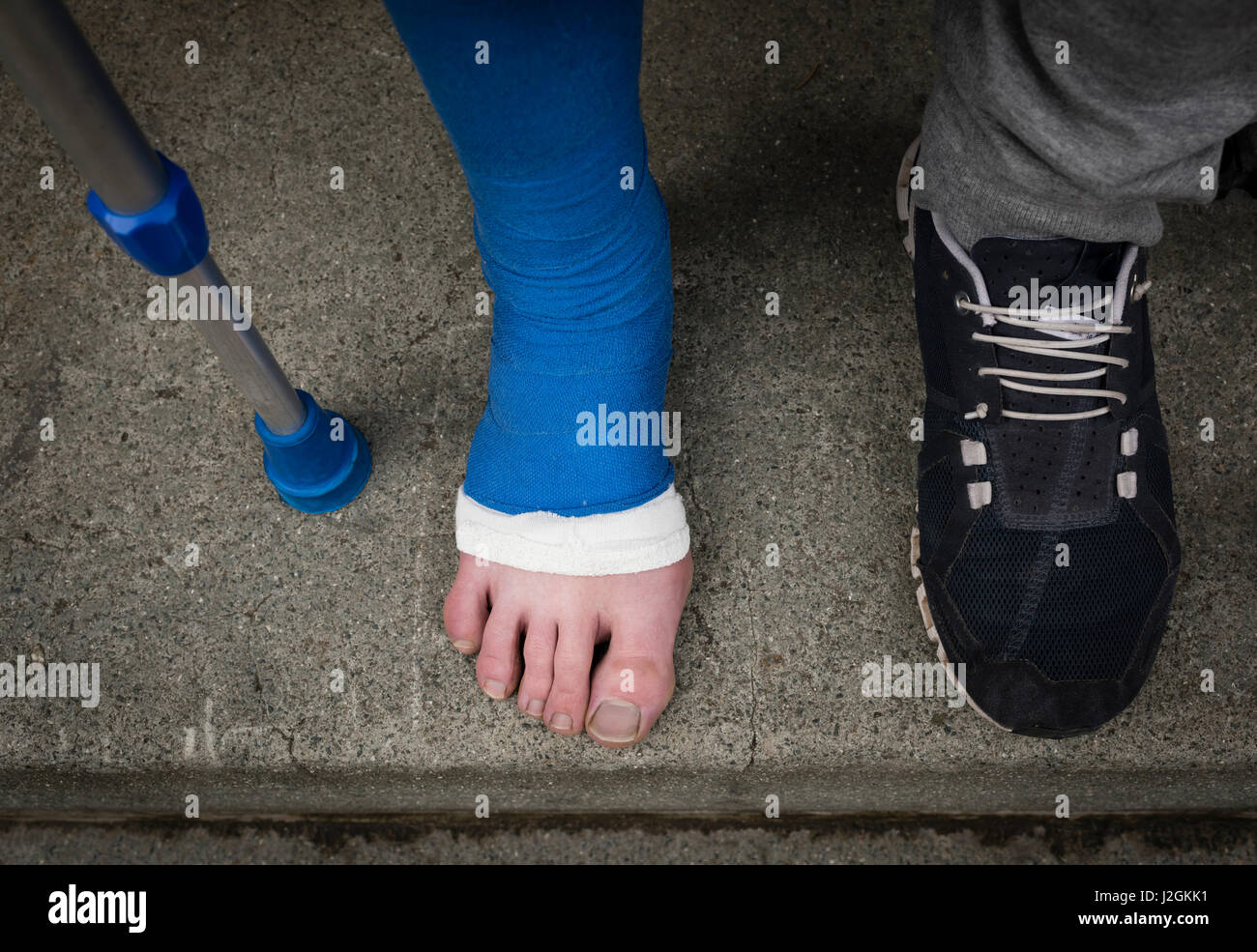 An der steinernen Tür außerhalb ein Appartement-Haus steht ein junger  Erwachsener mit Krücken und seinen Fuß in Gips bandagiert. Barfuß Zehen  kleben Stockfotografie - Alamy