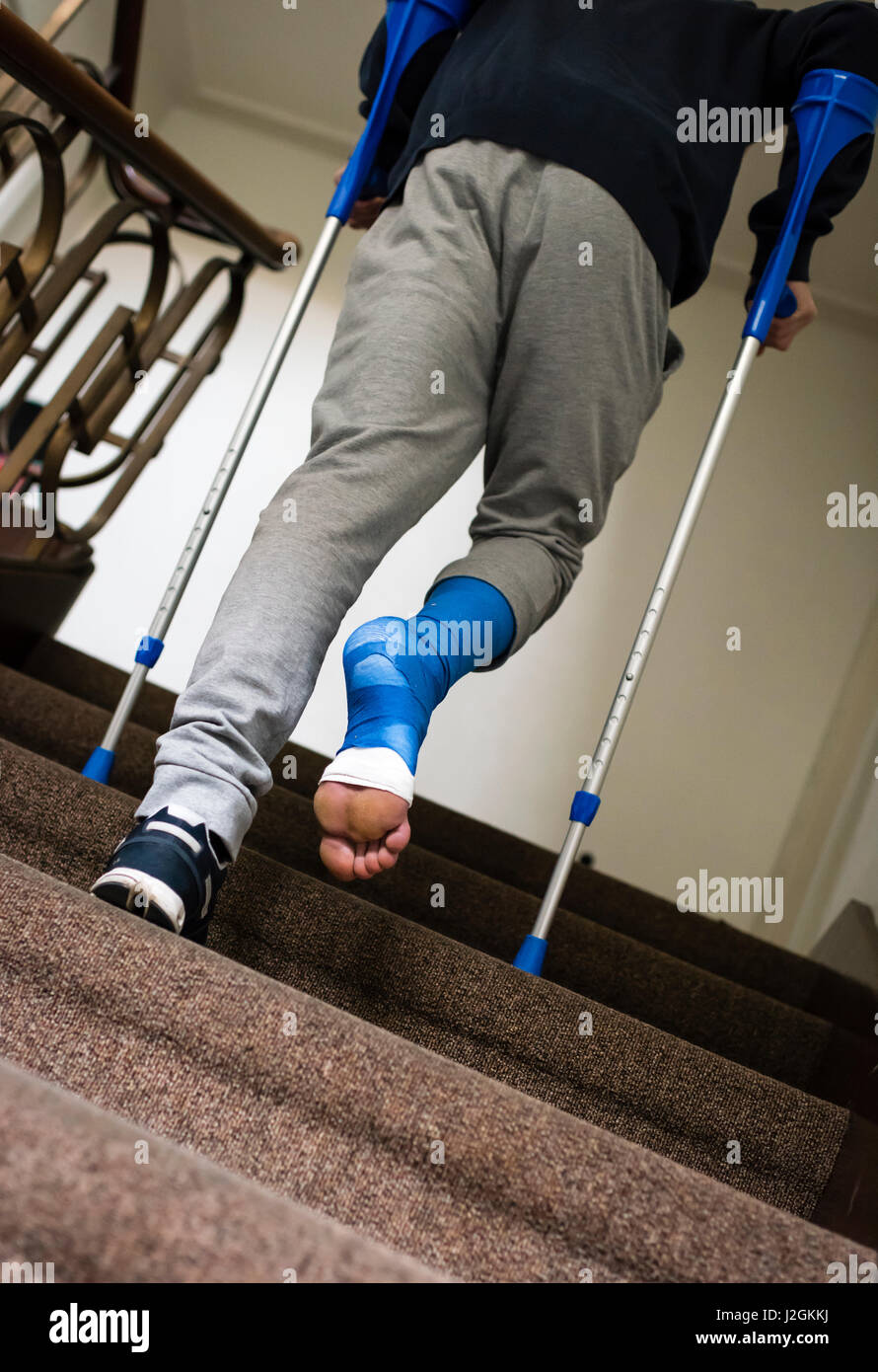 Bein gips krücken -Fotos und -Bildmaterial in hoher Auflösung – Alamy