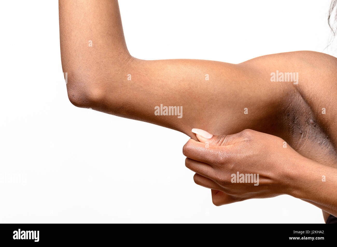 Junge Afrikanerin, die Anzeige der schlaffe Haut oder Fettpölsterchen durch Alterung am oberen Arm Kneifen es zwischen ihren Fingern, Nahaufnahme Stockfoto