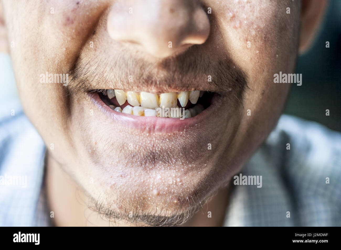 Ein Junge zeigt seine schmutzige Zähne Stockfoto