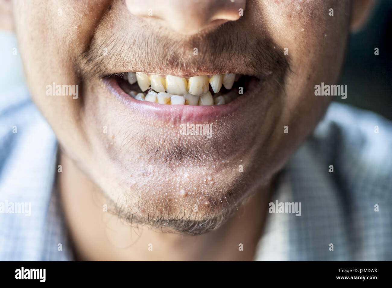 Ein Junge zeigt seine schmutzige Zähne Stockfoto