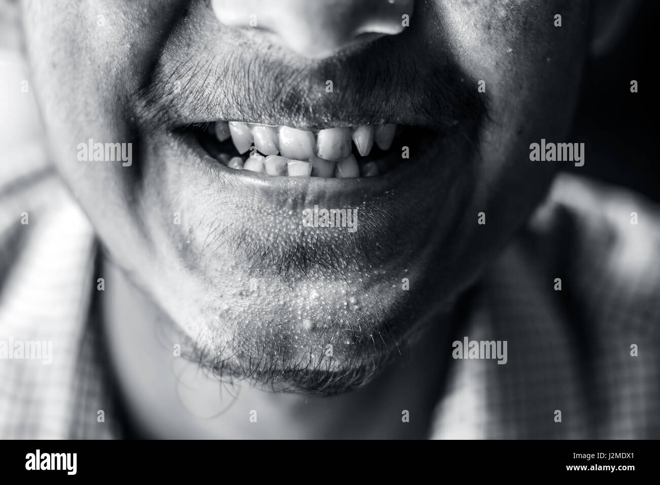 Ein Junge zeigt seine schmutzige Zähne Stockfoto
