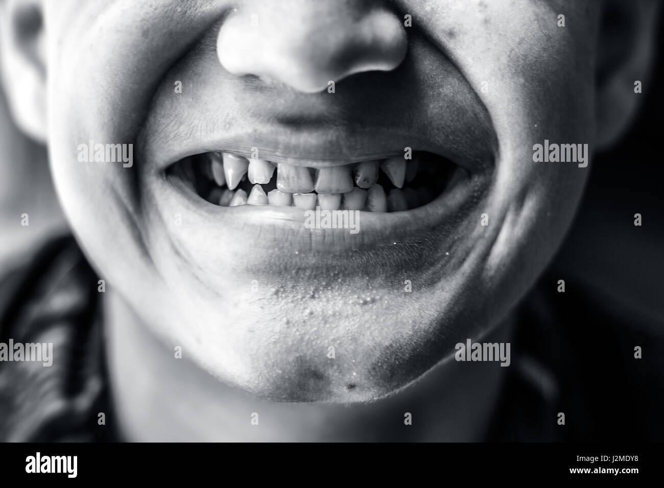 Ein Junge seine schmutzige Zähne zeigen. Stockfoto