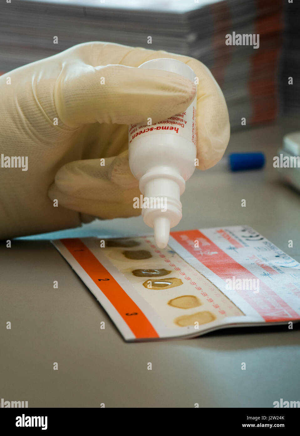 Testen von Kotproben auf ein Darm screening-Karte auf das Vorhandensein von okkultes Blut im Stuhl (versteckt) Stockfoto