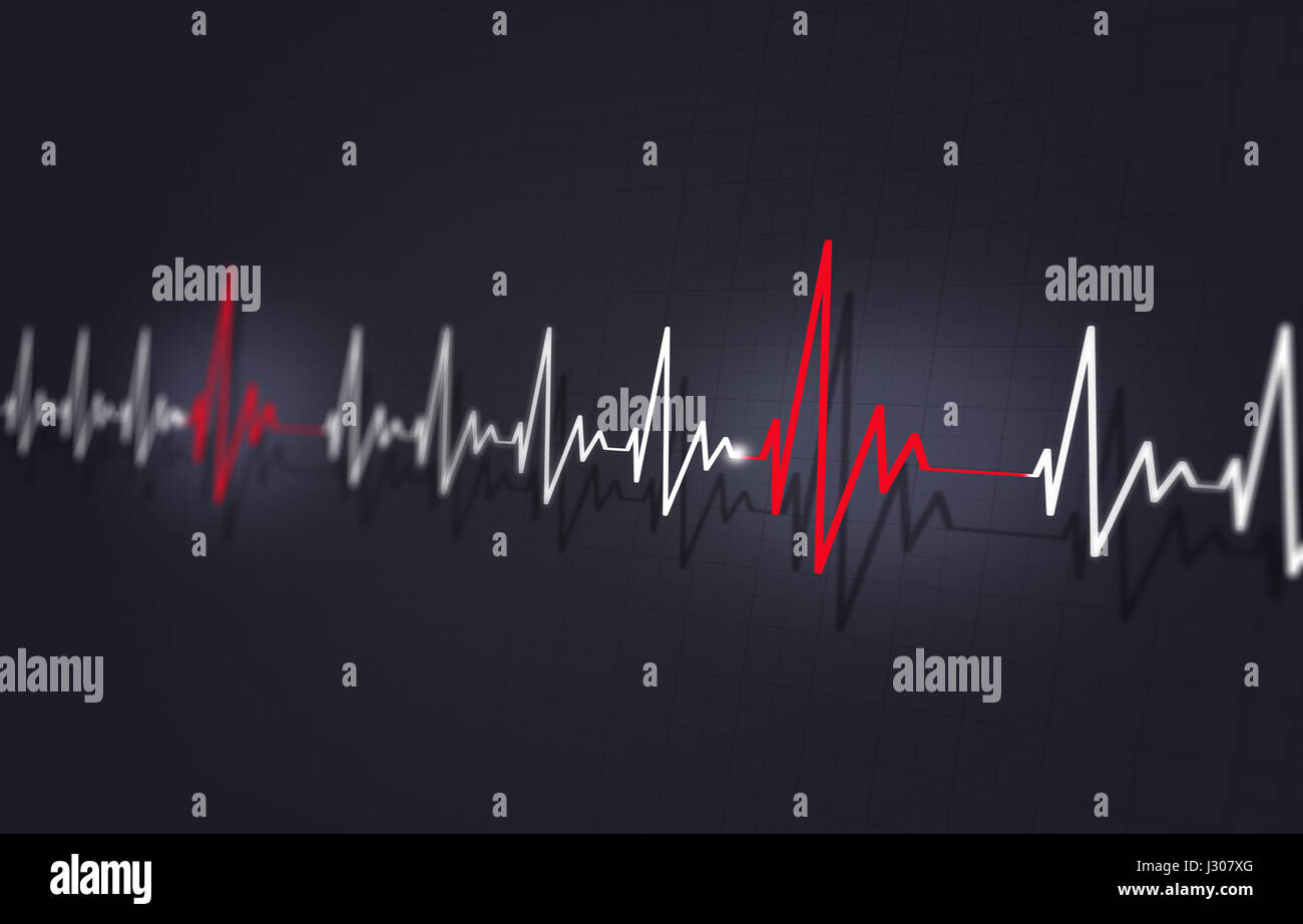 Medizin-Abbildung von Herz-Kreislauferkrankungen unregelmäßige schneller Puls Stockfoto