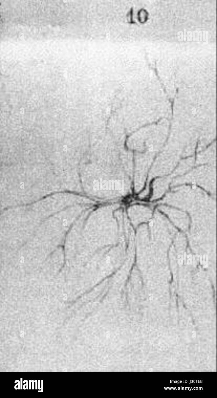 Die „Astrocyte Deiters“ bezieht sich auf eine Art von Gliazellen im Nervensystem, die für die Unterstützung und Erhaltung von Neuronen von entscheidender Bedeutung sind. Es spielt eine bedeutende Rolle bei der strukturellen Integrität und Funktion des Gehirns, insbesondere bei der Kommunikation zwischen Neuronen und der Blut-Hirn-Schranke. Stockfoto