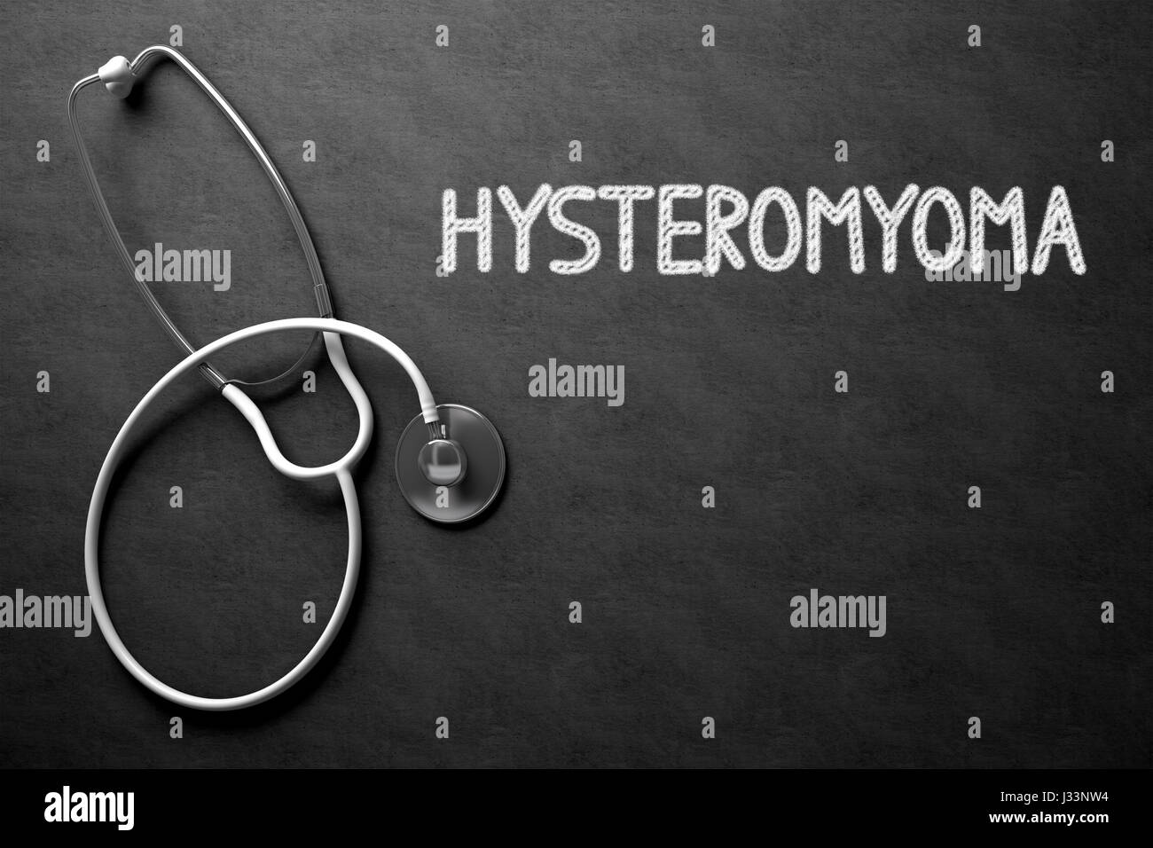 Hysteromyoma Konzept an Tafel. 3D Illustration Stockfotografie Alamy