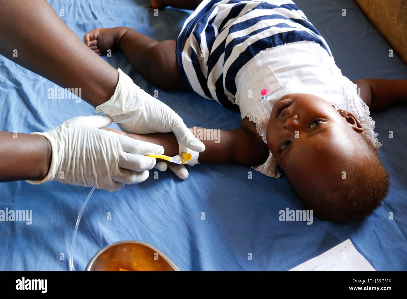 Bweyale medizinisches Zentrum. Kind an Malaria. Stockfoto