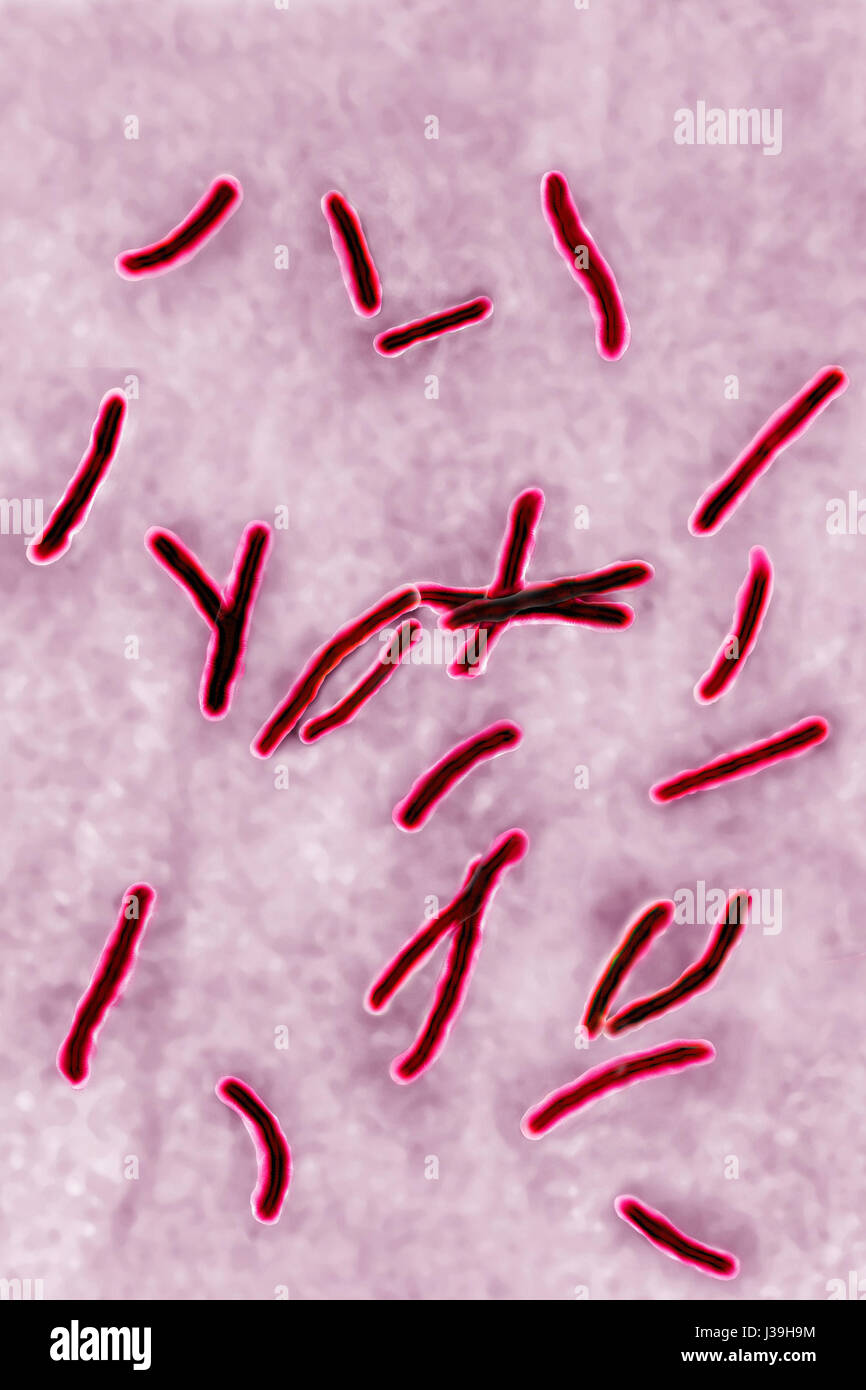 Mycobacterium Tuberculosis Stockfotos und bilder Kaufen Alamy