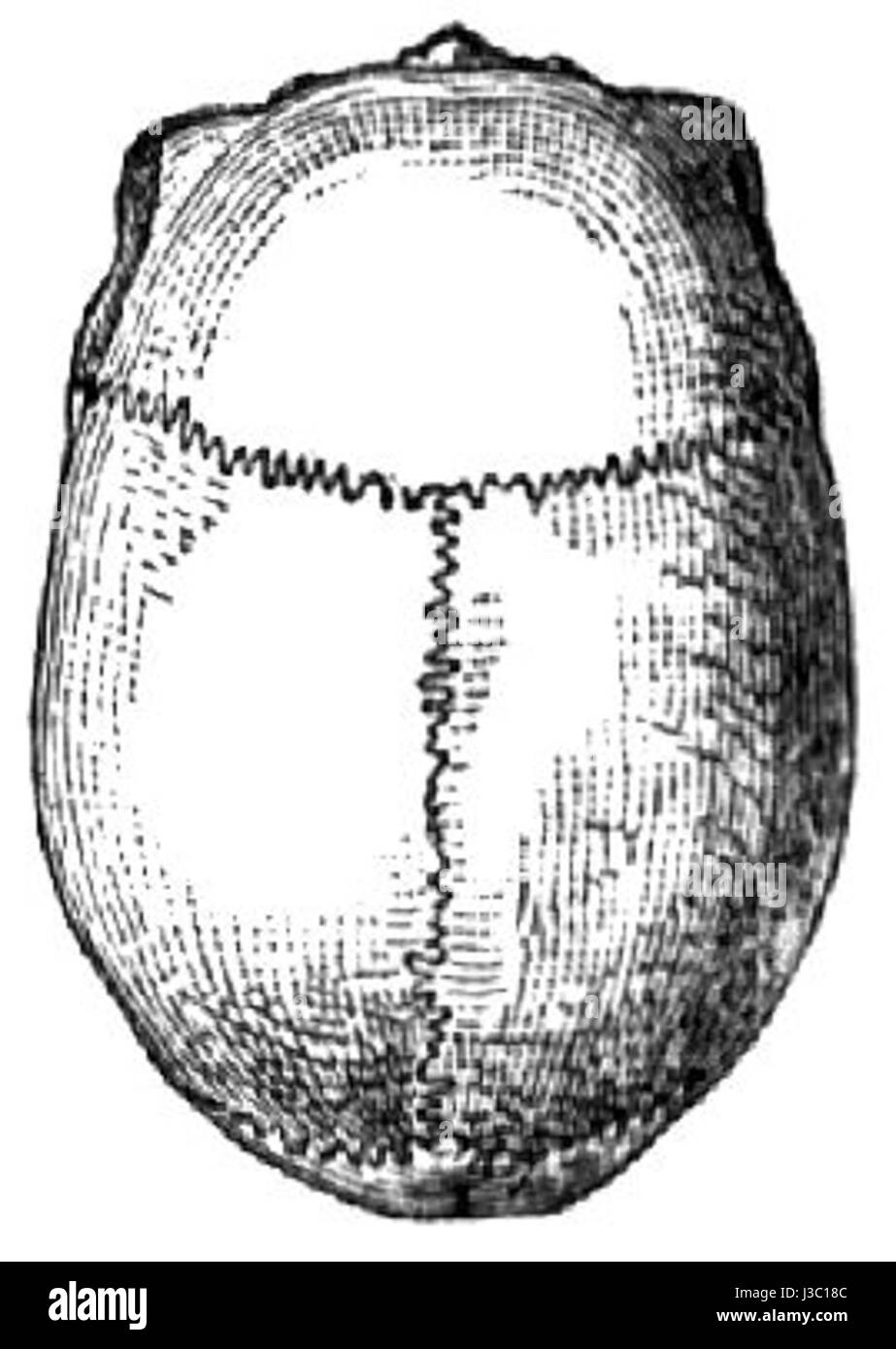 Dolichocephalie bezeichnet eine Erkrankung, die durch einen ungewöhnlich langen Schädel gekennzeichnet ist, der in bestimmten Populationen oder als genetisches Merkmal zu finden ist. Es ist ein Begriff, der in der Anthropologie und Humanbiologie verwendet wird, um Veränderungen der Kopfform zu beschreiben. Stockfoto