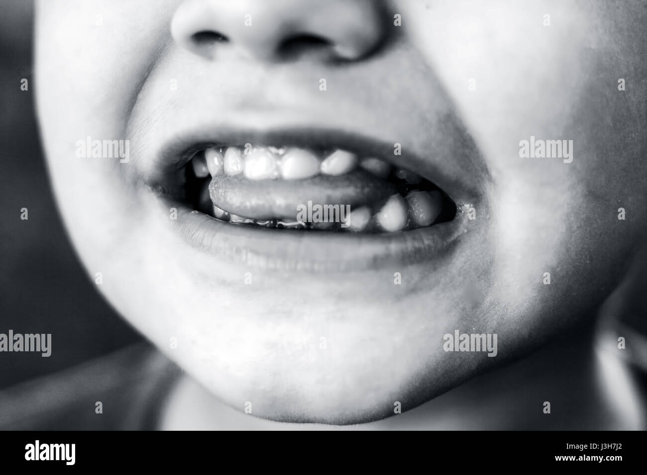 Lücke zwischen den zähnen Fotos und Bildmaterial in hoher Auflösung Alamy