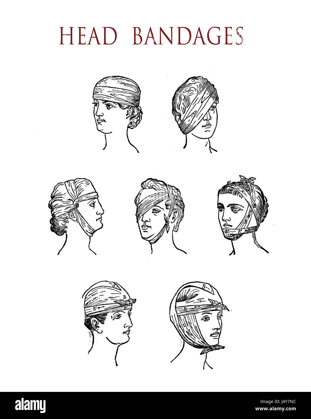 Vintage Illustration, wie man einen verletzten Kopf oder Augen Verband Stockfoto