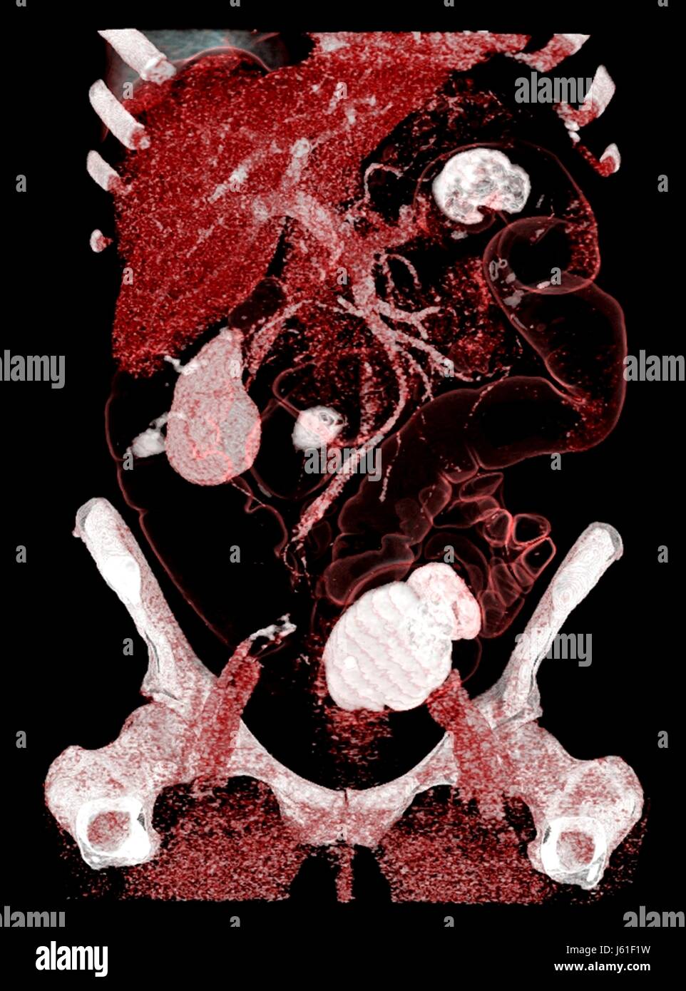 3d ct reconstruction Fotos und Bildmaterial in hoher Auflösung Alamy