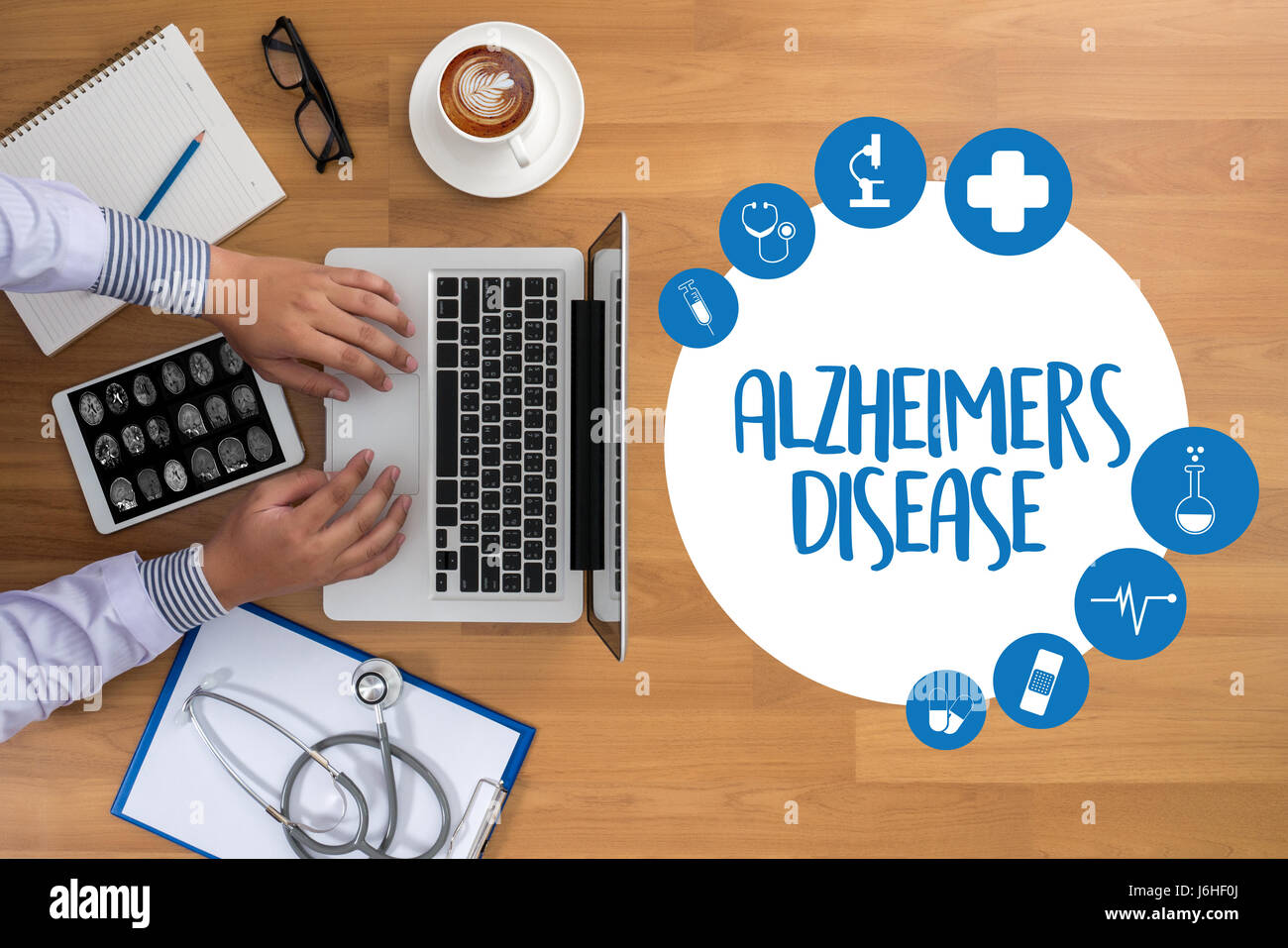 Alzheimer-Krankheit-Konzept, degenerative Erkrankungen des Gehirns Parkinson Stockfoto