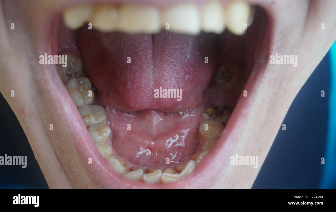 Mit schlechte 30 zähne Zahnarzt