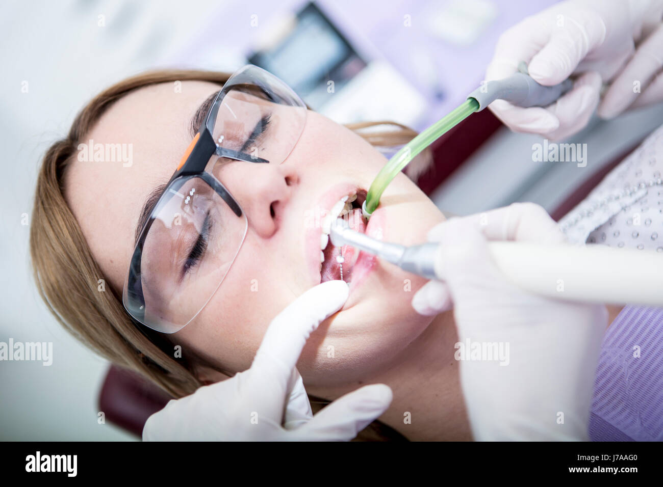 Frau beim Zahnarzt Wurzelbehandlung erhalten Stockfoto