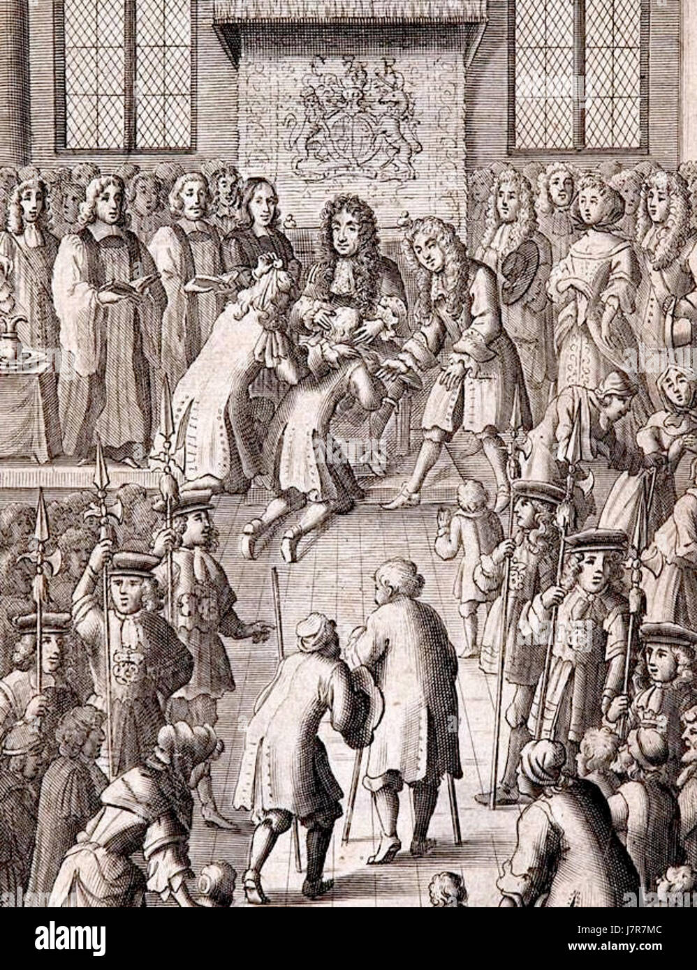 Charles II berühren die Skrofeln Stockfoto