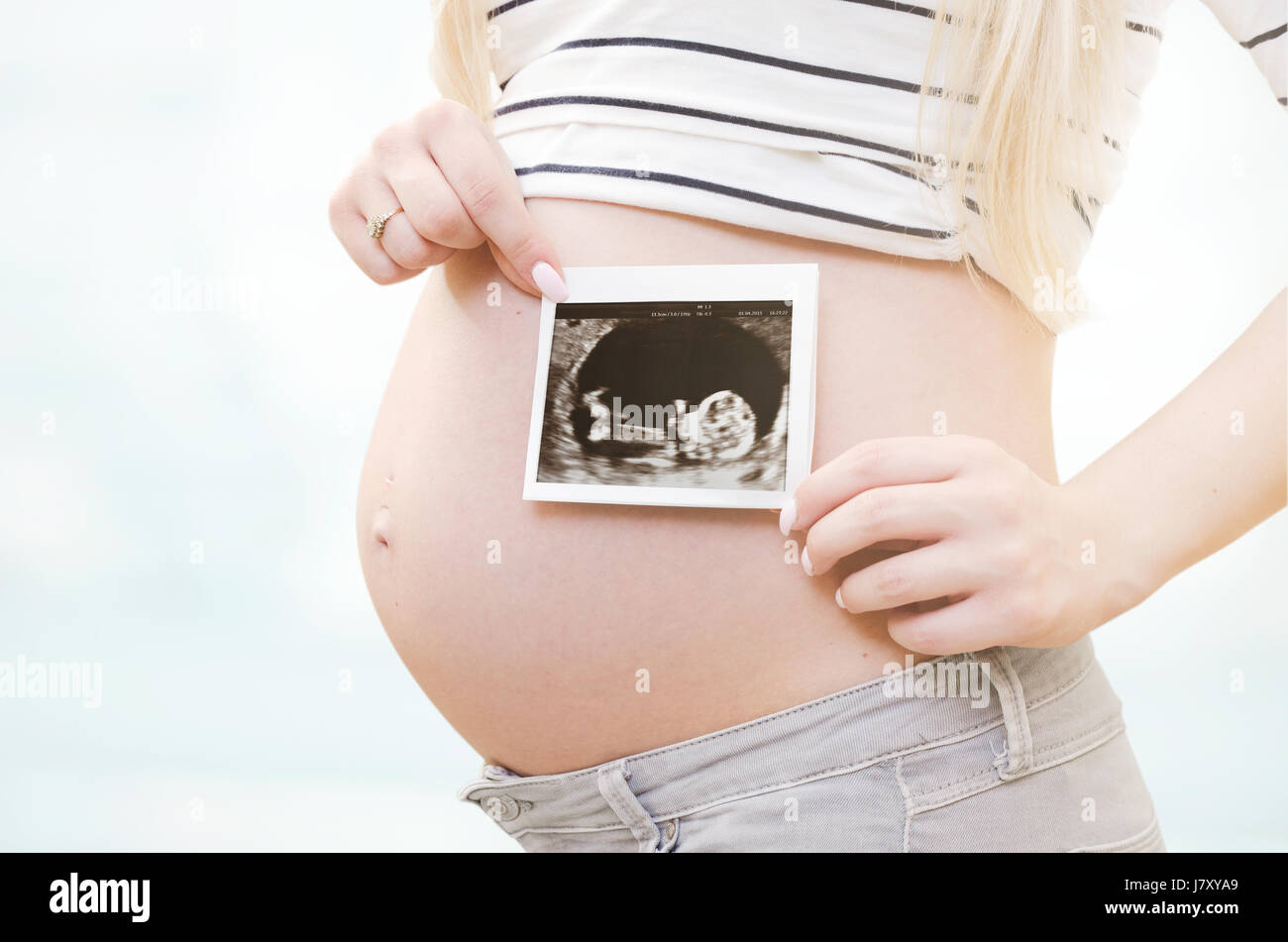 Baby Scan Hand Stockfotos Baby Scan Hand Bilder Alamy