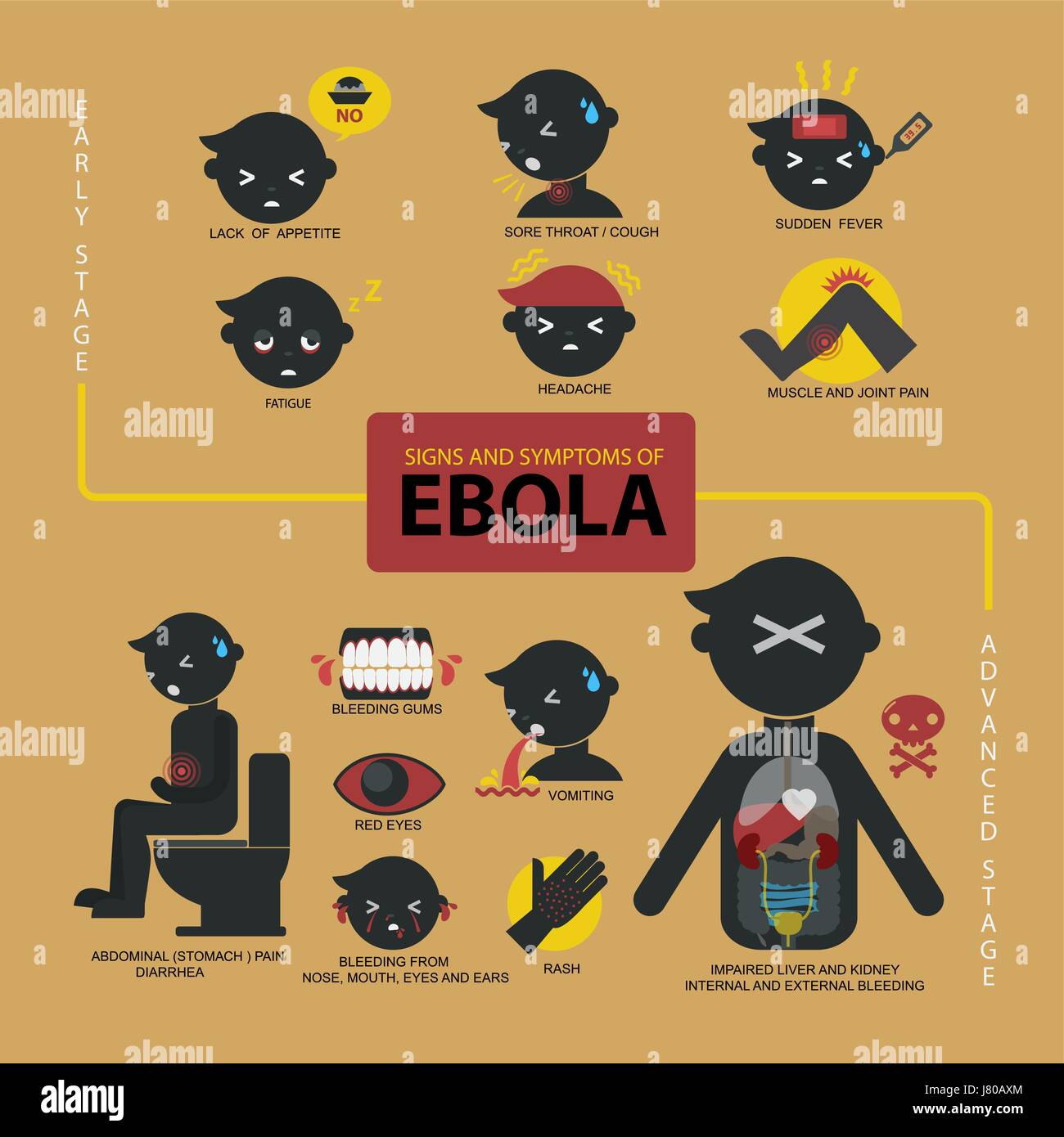 Flache Vektor der Ebola-Anzeichen und Symptome. Stock Vektor