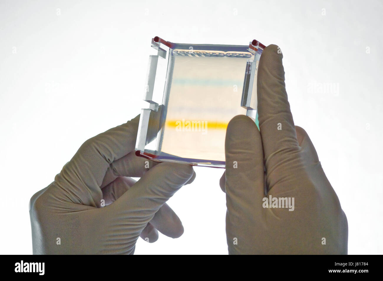 Hände halten Agarophose Elektrophorese Gel, farbig zeigen verschiedene Bands der Farbstoff Indikatoren Kennzeichnung Reisen der DNA-Moleküle sich das gel Stockfoto