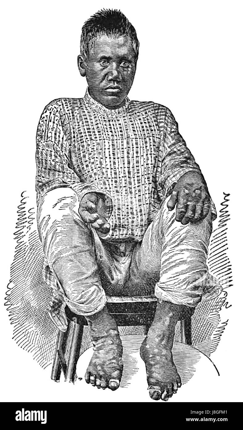 Dies bezieht sich auf eine fotografische Fallstudie, „Kaapu CASE XII“, die ein bestimmtes Ereignis, eine bestimmte Szene oder ein bestimmtes Motiv dokumentiert. Das Foto kann einen wichtigen Moment oder ein wichtiges Thema innerhalb der Studie darstellen. Stockfoto