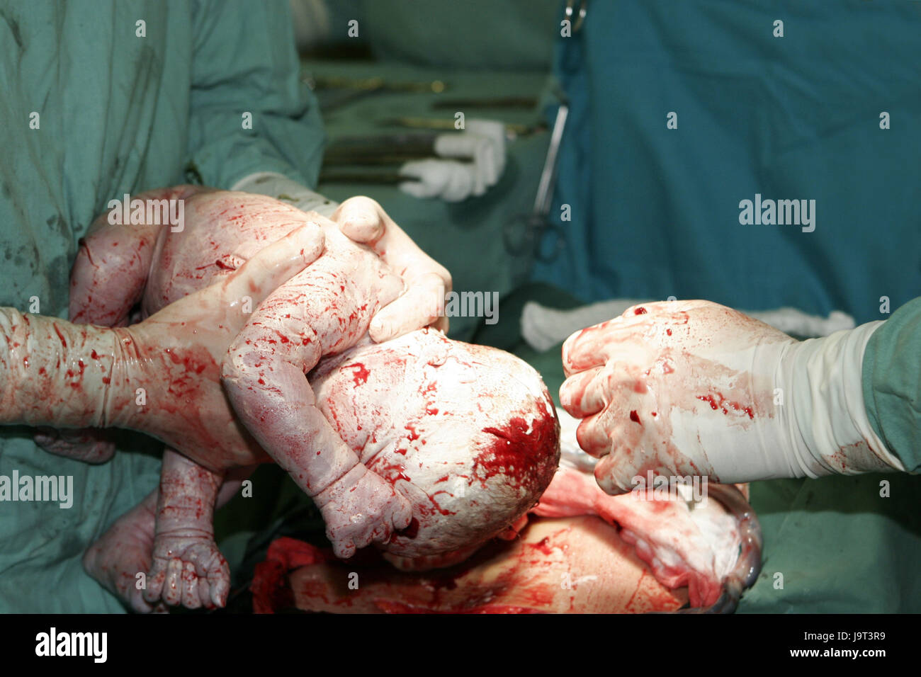 Halle eines Kreises, Geburt, Stockfoto