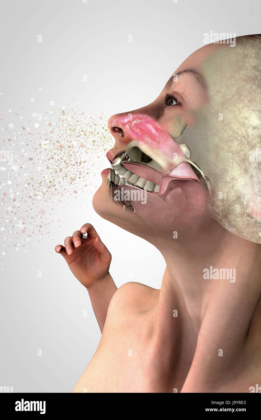 Symptome von einer kalten, menschliche Anatomie, 3D-Schnitt eines Gesichts, Mädchen mit kalten. Pollenallergie. 3D-Rendering Stockfoto
