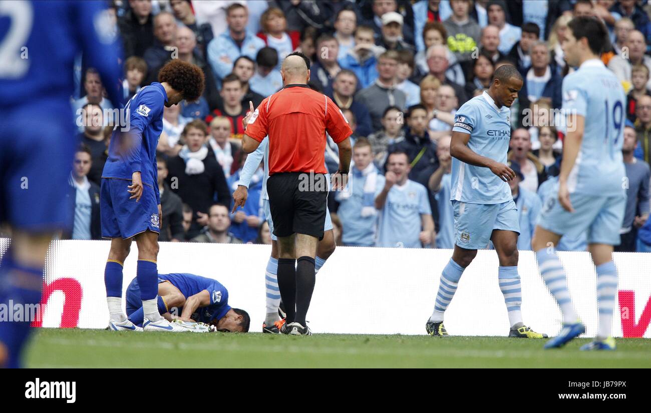 TIM CAHILL Verletzungen MANCHESTER CITY V EVERTON FC MANCHESTER CITY V EVERTON FC ETHIAD Stadion MANCHESTER ENGLAND 24 September 201 Stockfoto