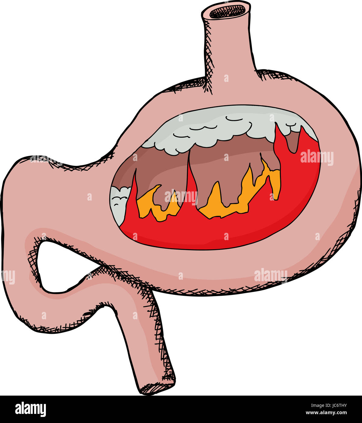 Symbol von saurem Reflux Verdauungsstörungen mit Flammen im Magen Stockfoto
