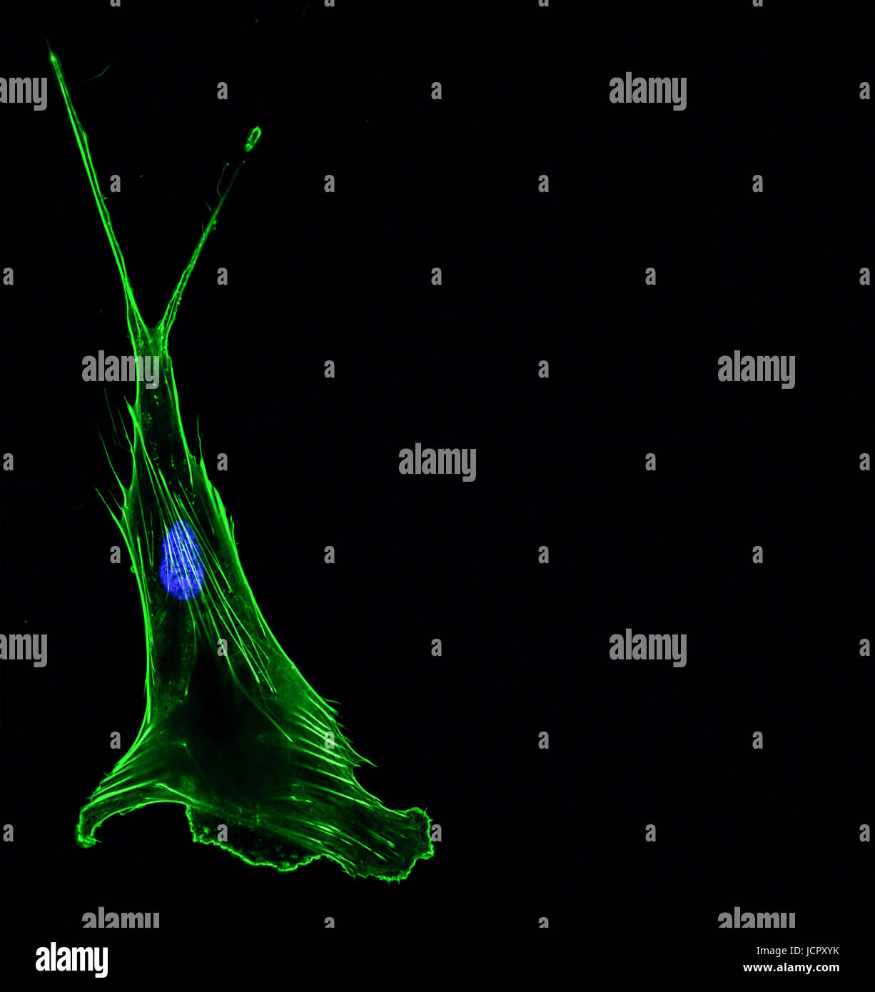 Immunfluoreszenz konfokale Abbildung einer einzigen invasive Lunge Krebs Zelle Cytoskelett in grün mit Kern in blau Stockfoto