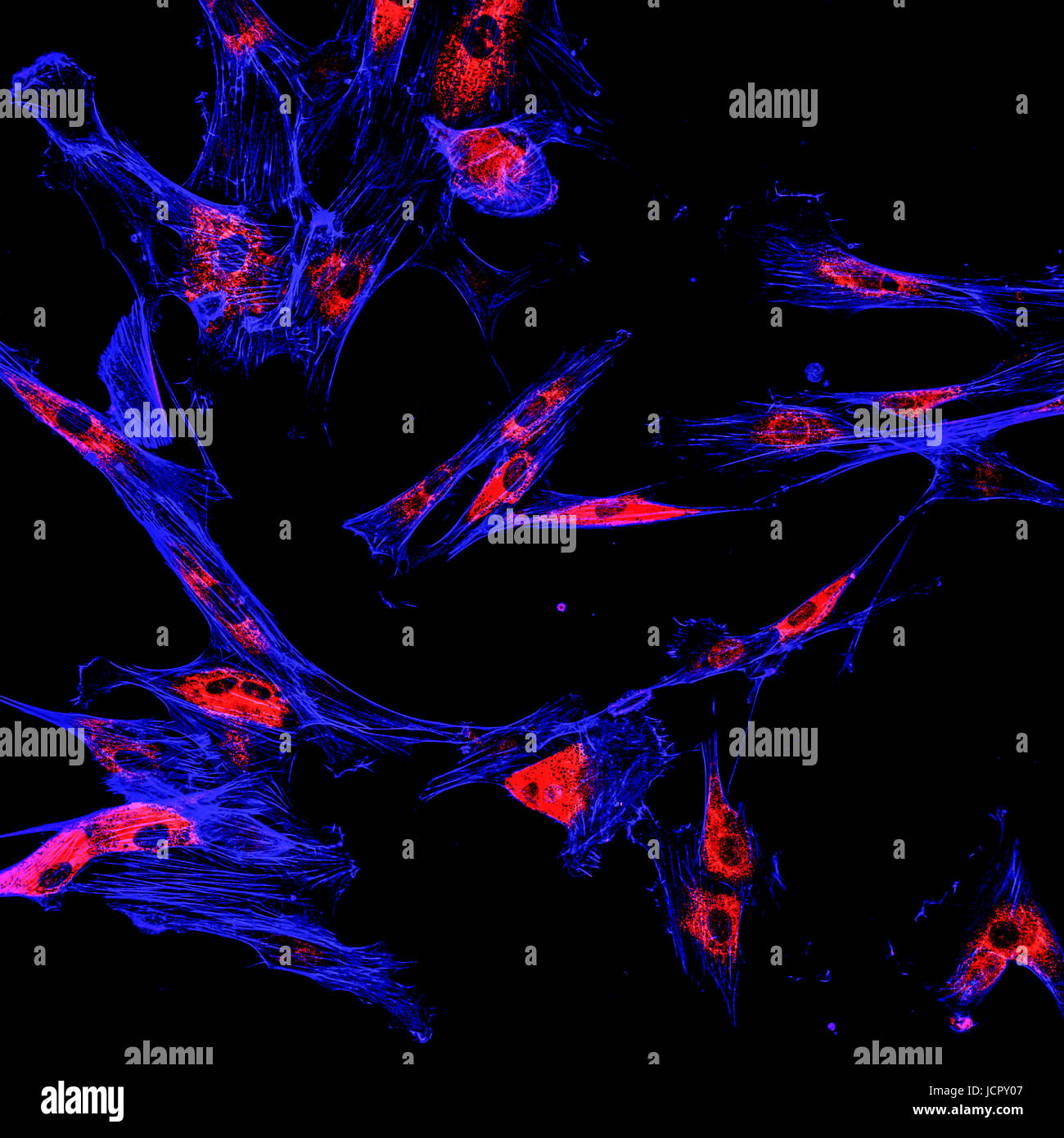 Immunfluoreszenz konfokale Abbildung von Melanomzellen Krebs Stockfoto