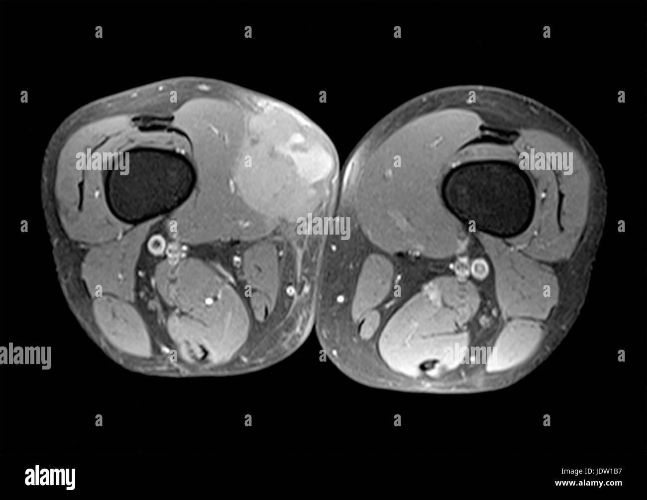 Nahaufnahme von x-ray Stockfoto