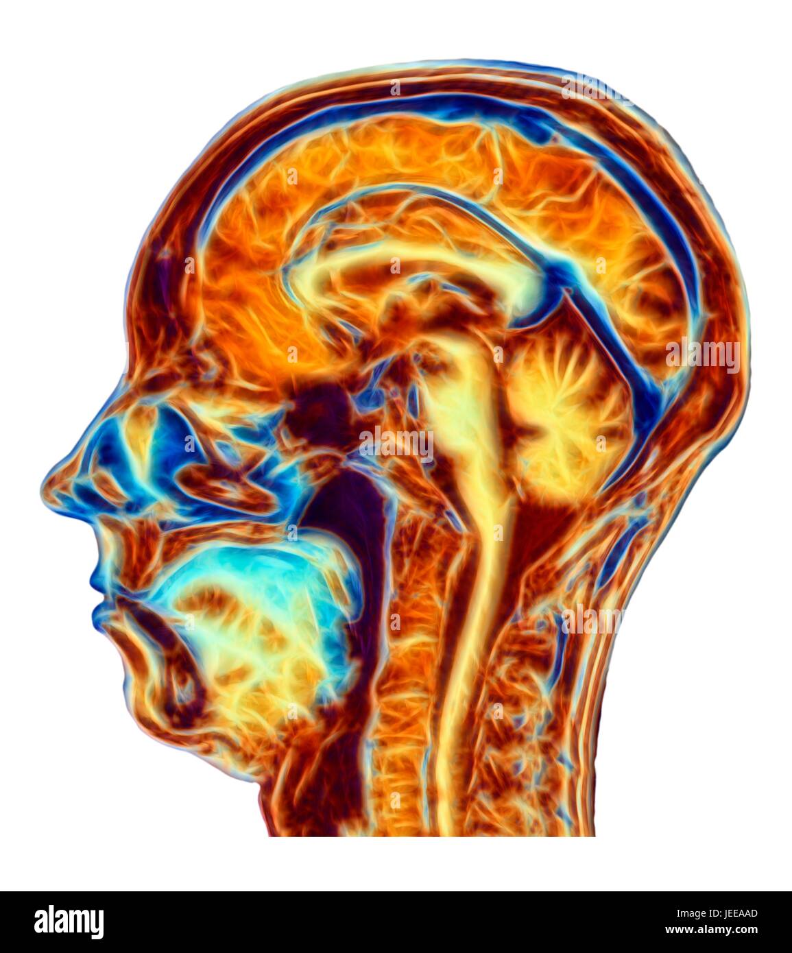 Computer verbessert, falsche Farbe Magnetic Resonance Bild (MRT) eine Mitte sagittale Abschnitts durch den Kopf einer normalen 46 jährige Frau, zeigt Strukturen im Gehirn, Wirbelsäule & Gesichtsbehandlung Gewebe. Profilierte verfügt über den wichtigsten Teil des Gehirns die gewundene Oberfläche der Hirnrinde, Corpus Callosum, Pons & Medulla, Strukturen des Hirnstamms, die kontinuierlich mit dem Rückenmark sind. Das Kleinhirn, das Zentrum der Balance & Koordination, liegt auf der rechten Seite der Hirnstamm. Stockfoto