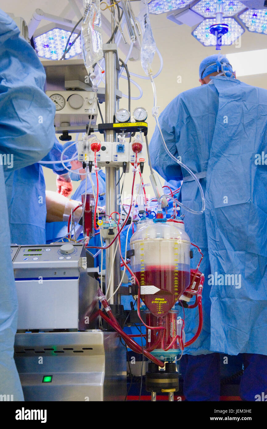 Blut-Reservoir der Perfusion-Maschine, die das Herz & Lunge Funktionen des Patienten mit Coronary Artery Bypass Graft Chirurgie übernommen hat. Stockfoto