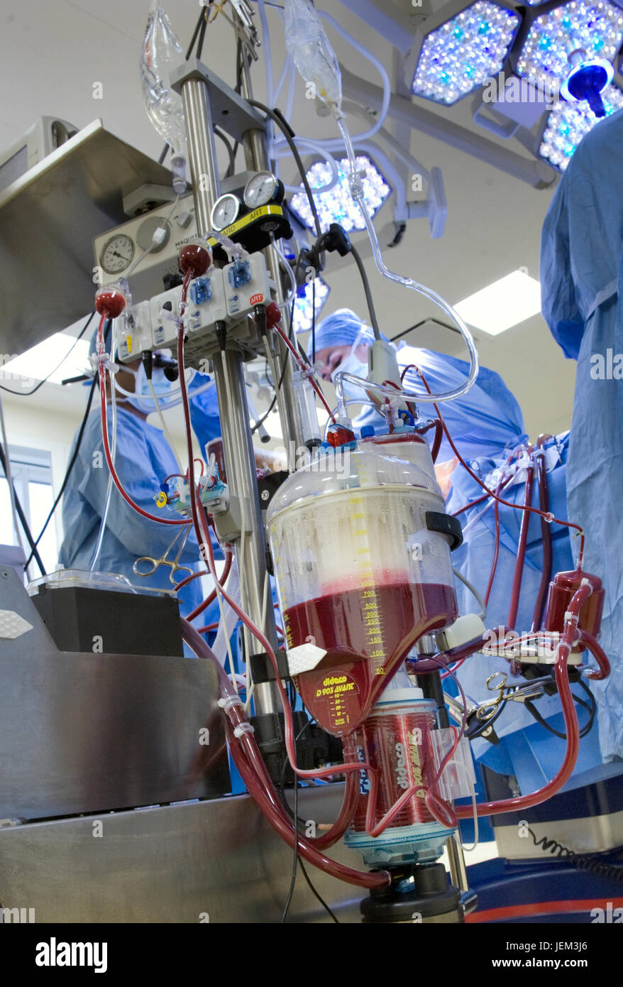 Blut-Reservoir der Perfusion-Maschine, die das Herz & Lunge Funktionen des Patienten mit Coronary Artery Bypass Graft Chirurgie übernommen hat. Stockfoto