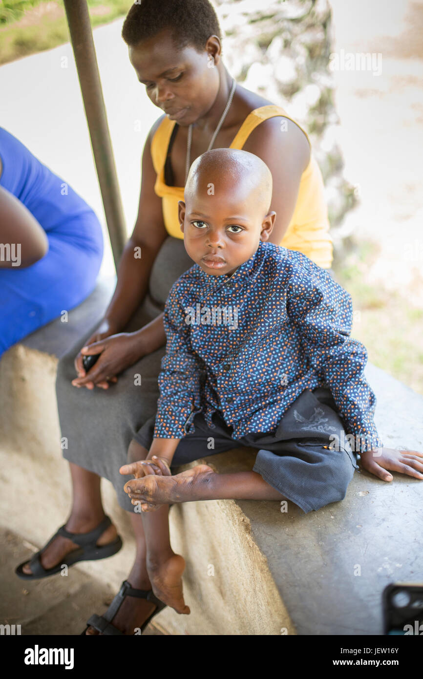 Junge mit Klumpfüße - Bundibugyo, Uganda. Stockfoto