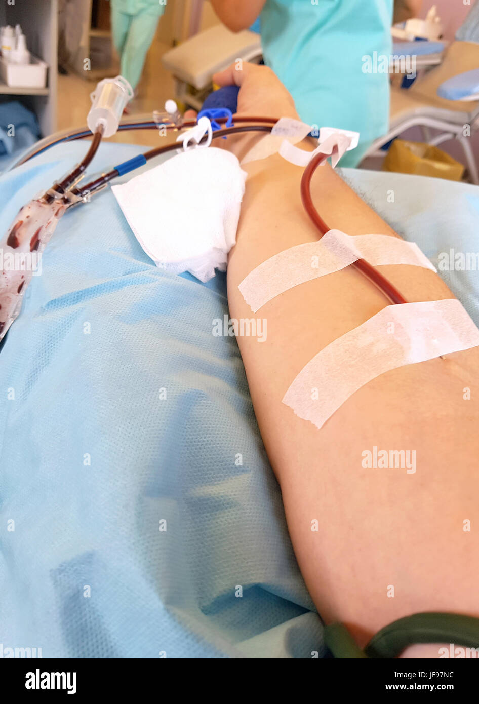 Arm eines Mannes beim Blutspenden am Klinikum Stockfoto