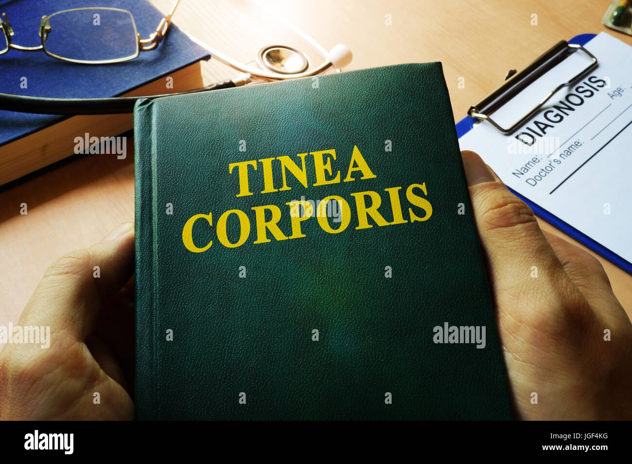 Hände halten Buch Tinea Corporis. Stockfoto