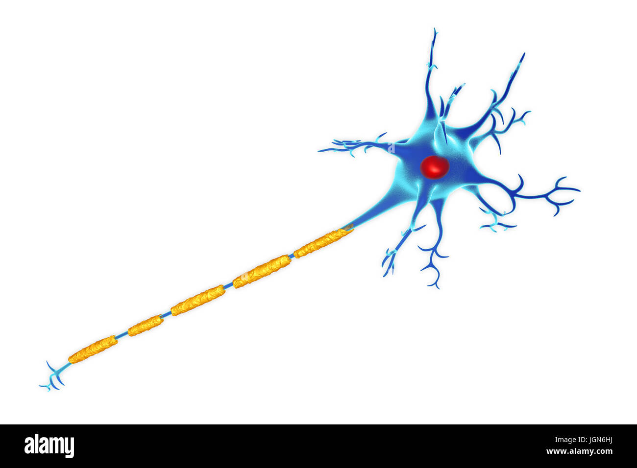 Illustration mit einer beschädigten Myelinscheide (gelb) um seine Axon einer Nervenzelle (Neuron). Stockfoto